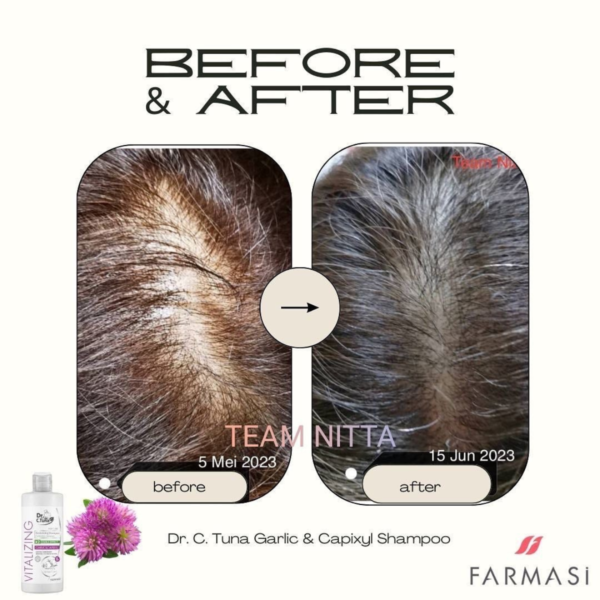 before and after 1