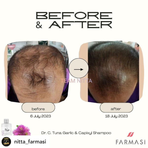 before and after 2